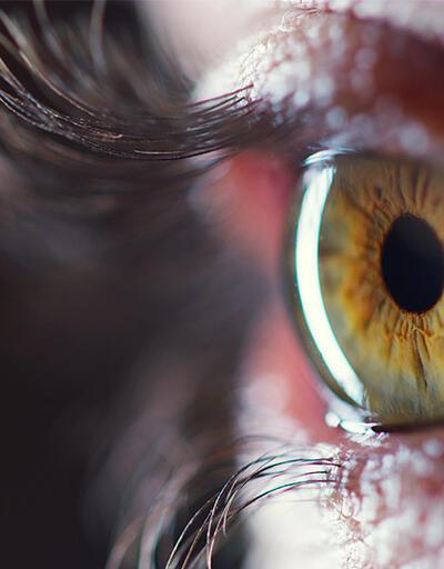 Sarı nokta hastalığı nedir? COVID-19 sürecinde sarı nokta hastalığı hafife alınmamalı!