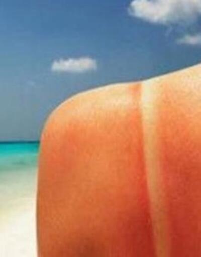 Uzun süreli güneş teması deri kanserlerinin görülme oranını artırdı