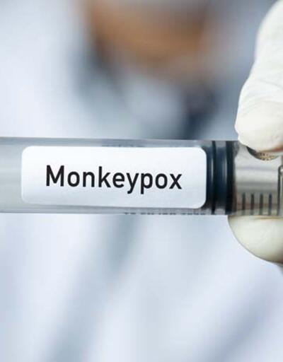 Uzmanı açıkladı: Maymun çiçeği virüsü ölümcül mü? Belirtileri neler, kimler risk altında?
