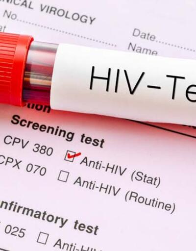 ABD'de HIV virüsü taşıyan bir kişinin daha AIDS'i yendiği açıklandı