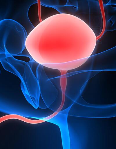 Prostat kanserinin tedavisinde teranostik yaklaşım nedir?