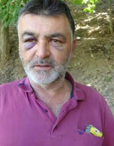 Aydın'da incir kavgasında 8 kişi hastanelik oldu