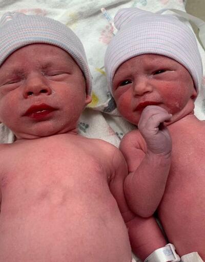 30 yıl önce dondurulan embriyolarla ikiz sahibi oldular
