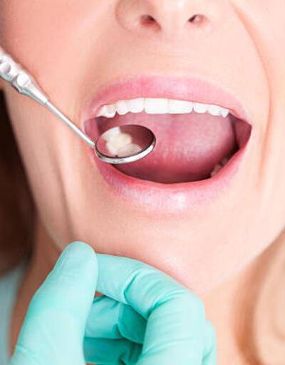 Çoğu kişi bu hatayı bilmeden her gün yapıyor! Diş sağlığını bozan 13 alışkanlık
