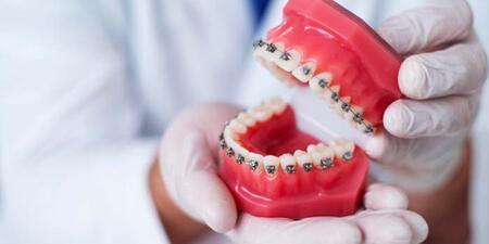 Strategi Dan Manajemen Perawatan Ortodontik Pada Pasien Adhd Unair News