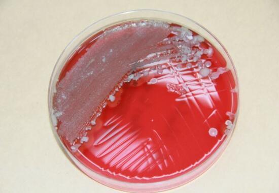 Uzun süre kullanılan maskedeki bakteriler laboratuvarda görüntülendi
