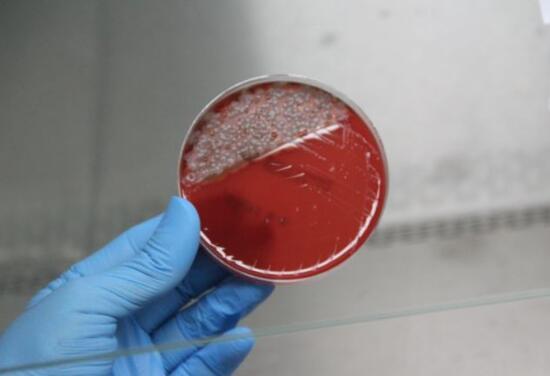 Uzun süre kullanılan maskedeki bakteriler laboratuvarda görüntülendi
