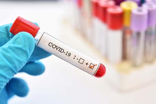 Farkında olmadan koronavirüs geçirdiğimiz nasıl anlaşılır?