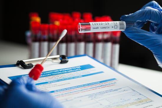 Milyonlarca çalışanı ilgilendiriyor: PCR testi yaptırmayan işten çıkarılabilir mi? İşte 13  tüm merak edilenler