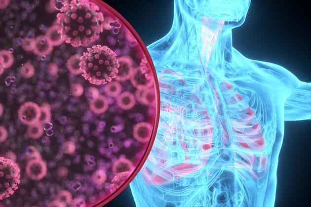En çok görülen kanser türlerli arasında ilk 5'te! Akciğer kanserinin belirtileri neler, nasıl tedavi edilir?