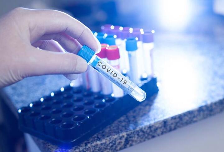 İşçi PCR testi zorunluluğu ne zaman başlıyor? Aşı olmayan işçiler haftada bir PCR testi yaptıracak!