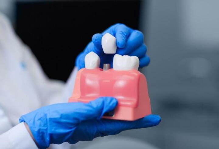 "Diş kaybı sorunlarında implant tedavisi en çok tercih edilen çözümler arasında”