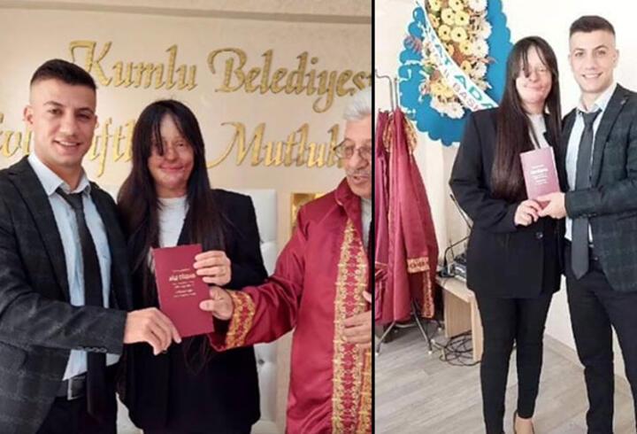 Türkiye günlerce Berfin Özek'i konuşmuştu! Yüzüne asit atan erkek arkadaşıyla evlendi