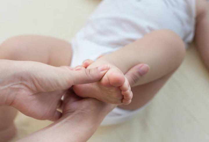 Doğuştan çarpık ayak sorunu ameliyatsız tedavi edilebiliyor