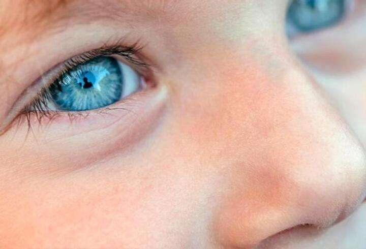 A vitamini eksikliği çocuklarda gözleri nasıl etkiliyor?