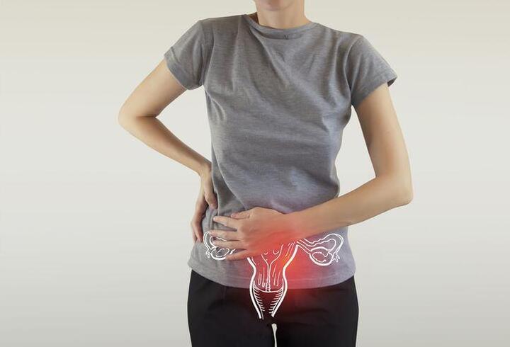 Kadınlarda bel ve sırt ağrıları, karında şişkinlik endometriozis işareti olabilir!