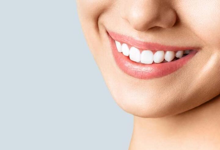 Diş taşı temizliği için 6 neden