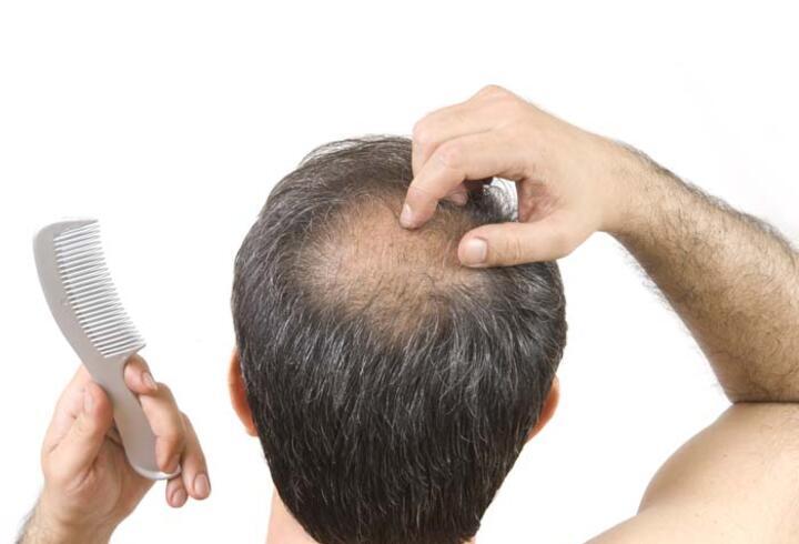 Saç tedavileri sonrası ödem nasıl geçer?