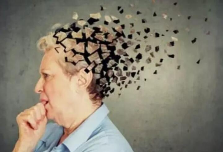 Alzheimer kadınlarda daha çok görülüyor