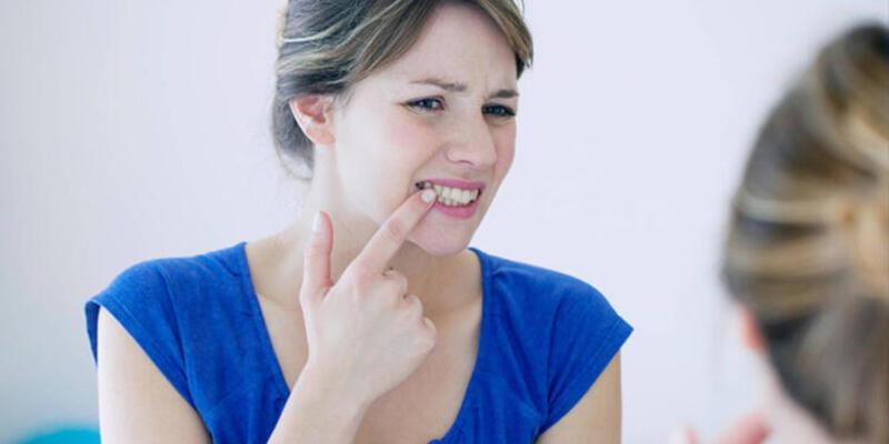 Diş eti kanamaları neden olur? Sağlık Haberleri