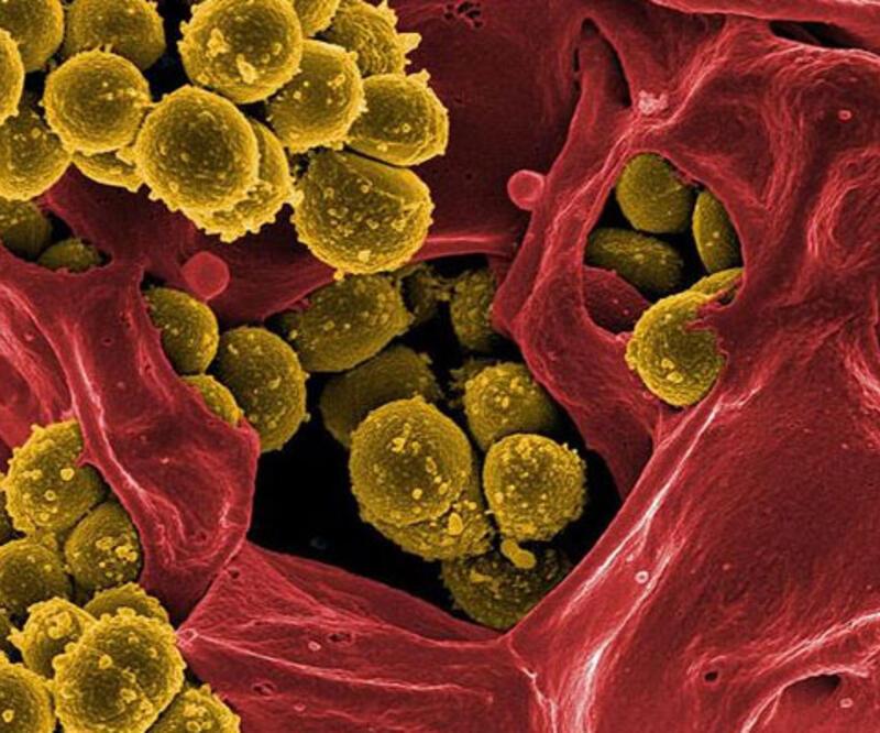 Araştırma: Bakterilerin "ölüm çığlığı" diğer bakterileri uyarıyor
