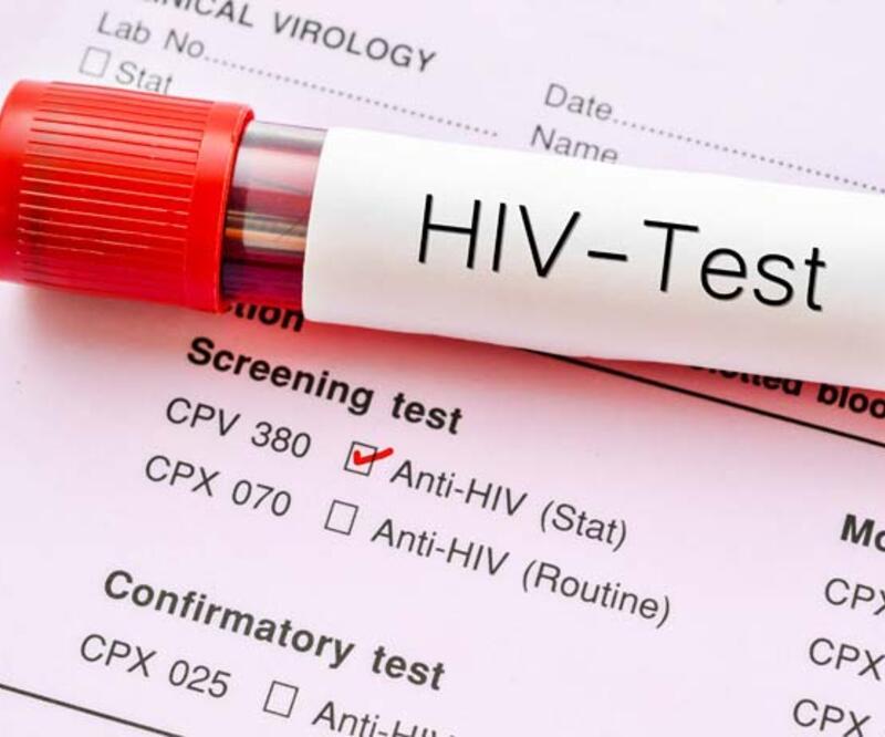 Prof. Dr. Şener: Sessiz bir 'HIV pandemisi' var
